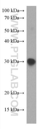 SARS-CoV-2 S protein (319-541 aa) Antibody in Western Blot (WB)