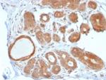 STAT5B Antibody in Immunohistochemistry (Paraffin) (IHC (P))