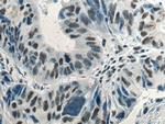 Phospho-mTOR (Ser2448) Antibody in Immunohistochemistry (Paraffin) (IHC (P))