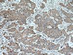 citrate synthase Antibody in Immunohistochemistry (Paraffin) (IHC (P))