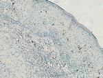 CD207 Antibody in Immunohistochemistry (Paraffin) (IHC (P))