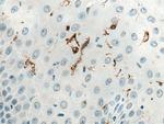 CD207 Antibody in Immunohistochemistry (Paraffin) (IHC (P))