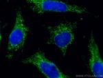 AIF Antibody in Immunocytochemistry (ICC/IF)