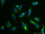 AIF Antibody in Immunocytochemistry (ICC/IF)