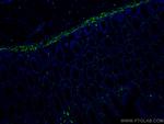 Desmin Antibody in Immunohistochemistry (Paraffin) (IHC (P))