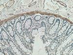 Desmin Antibody in Immunohistochemistry (Paraffin) (IHC (P))