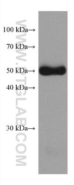 Desmin Antibody in Western Blot (WB)