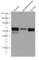 Desmin Antibody in Western Blot (WB)