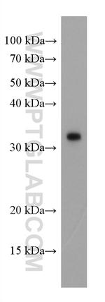 SARS-CoV-2 S protein (944-1214 aa) Antibody in Western Blot (WB)