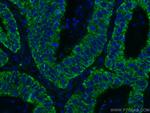 CNOT4 Antibody in Immunohistochemistry (Paraffin) (IHC (P))