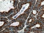 CNOT4 Antibody in Immunohistochemistry (Paraffin) (IHC (P))