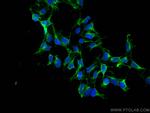 EIF4A2 Antibody in Immunocytochemistry (ICC/IF)