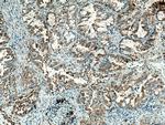 HK3 Antibody in Immunohistochemistry (Paraffin) (IHC (P))