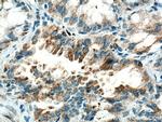 HK3 Antibody in Immunohistochemistry (Paraffin) (IHC (P))