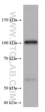 HK3 Antibody in Western Blot (WB)