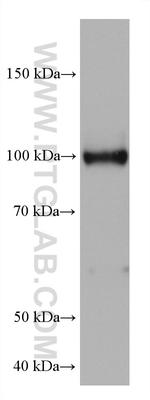 HK3 Antibody in Western Blot (WB)