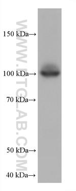 HK3 Antibody in Western Blot (WB)