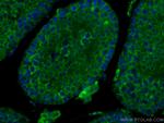 SMCR7L Antibody in Immunohistochemistry (Paraffin) (IHC (P))