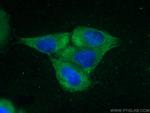 LARP1 Antibody in Immunocytochemistry (ICC/IF)