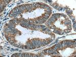 LARP1 Antibody in Immunohistochemistry (Paraffin) (IHC (P))