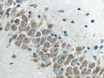 FXR1 Antibody in Immunohistochemistry (Paraffin) (IHC (P))