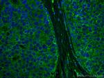 DAPK1 Antibody in Immunohistochemistry (Paraffin) (IHC (P))