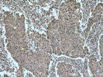 DAPK1 Antibody in Immunohistochemistry (Paraffin) (IHC (P))