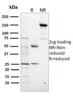 Sulfotransferase family 1E, estrogen-preferring, member 1 Antibody in SDS-PAGE (SDS-PAGE)