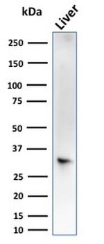 Sulfotransferase family 1E, estrogen-preferring, member 1 Antibody in Western Blot (WB)