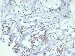 Sulfotransferase family 1E, estrogen-preferring, member 1 Antibody in Immunohistochemistry (Paraffin) (IHC (P))