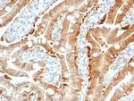 Sulfotransferase family 1E, estrogen-preferring, member 1 Antibody in Immunohistochemistry (Paraffin) (IHC (P))