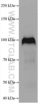 THBD Antibody in Western Blot (WB)