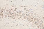 OXCT1 Antibody in Immunohistochemistry (Paraffin) (IHC (P))