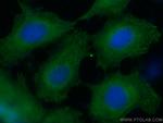 CAPNS1 Antibody in Immunocytochemistry (ICC/IF)