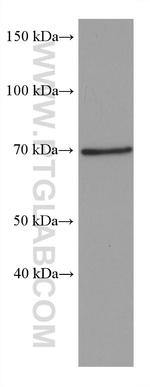 SH3BP5 Antibody in Western Blot (WB)