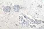 HNRNPA1 Antibody in Immunohistochemistry (Paraffin) (IHC (P))