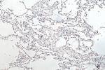 HNRNPA1 Antibody in Immunohistochemistry (Paraffin) (IHC (P))