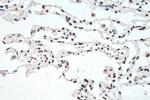 HNRNPA1 Antibody in Immunohistochemistry (Paraffin) (IHC (P))