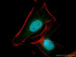 RUVBL2 Antibody in Immunocytochemistry (ICC/IF)