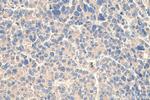 AFP Antibody in Immunohistochemistry (Paraffin) (IHC (P))