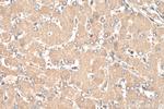 AFP Antibody in Immunohistochemistry (Paraffin) (IHC (P))