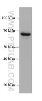 AFP Antibody in Western Blot (WB)