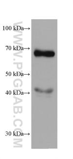 AFP Antibody in Western Blot (WB)