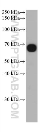 AFP Antibody in Western Blot (WB)