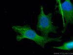 EFTUD2 Antibody in Immunocytochemistry (ICC/IF)