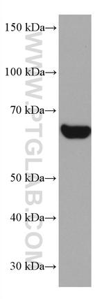 CBS Antibody in Western Blot (WB)