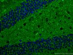 Synaptophysin Antibody in Immunohistochemistry (Paraffin) (IHC (P))