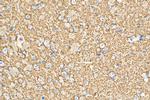 Synaptophysin Antibody in Immunohistochemistry (Paraffin) (IHC (P))