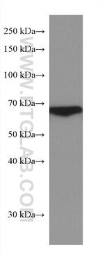 HABP2 Antibody in Western Blot (WB)