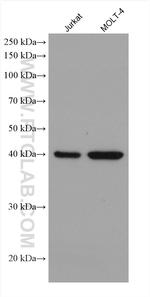 ADA Antibody in Western Blot (WB)